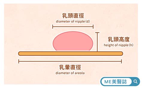 乳頭黑色素